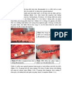 Mô mềm quanh răng và implant p2