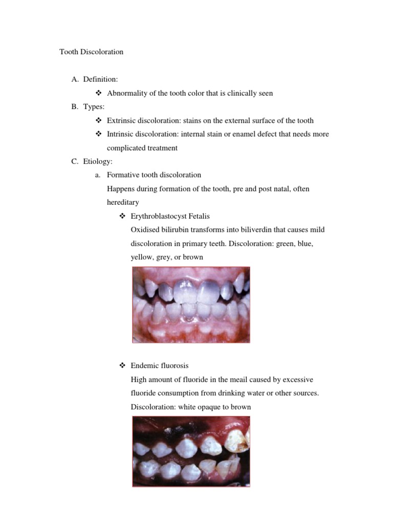 Tooth Discoloration Human Tooth Tooth Enamel