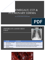 Cardiomegaly, CCF, Pulmonary Edema