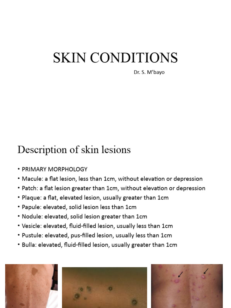 Overview of Common Skin Conditions | PDF | Dermatitis | Clinical Medicine