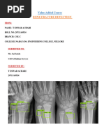 Bone Fracture Detection