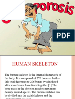 Osteoprosis