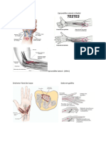 Tendinite de Quervain Síndrome Do Túnel Do Carpo
