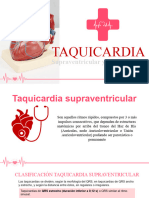 Taquicardias