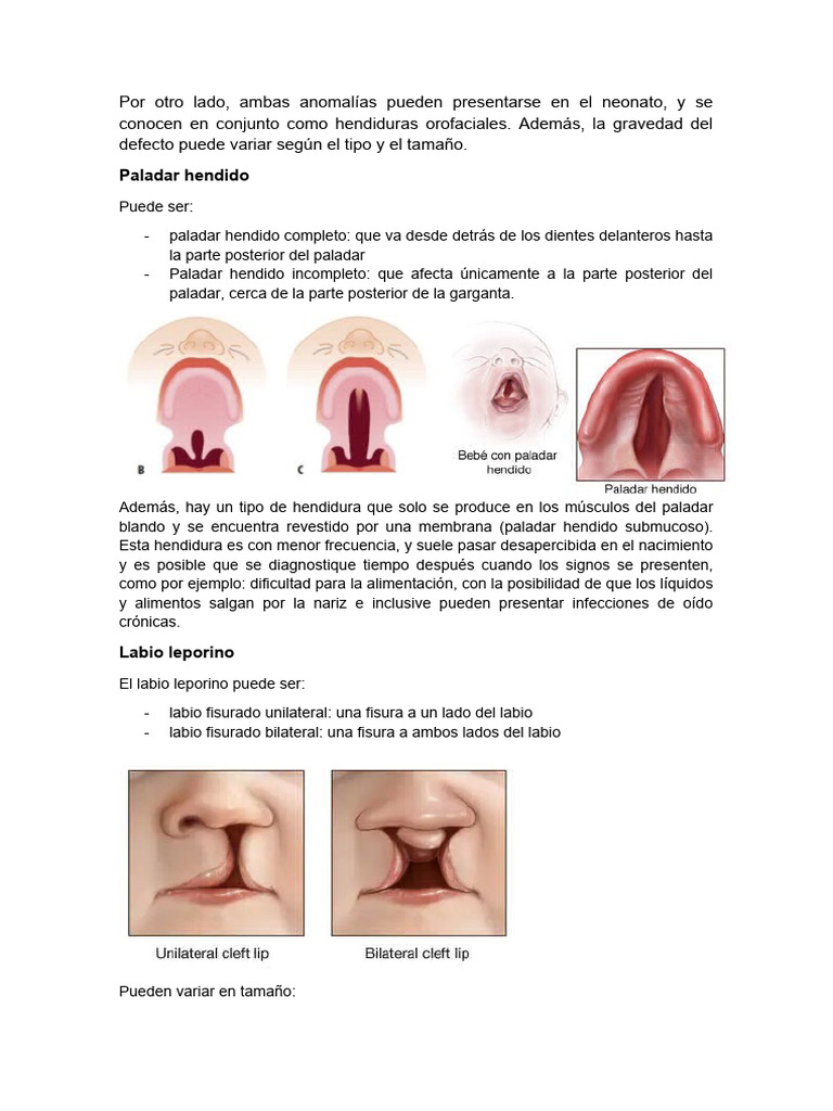 Labio Leporino y Paladar Blando | PDF | Ciencias de la Salud | Medicina ...