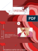 EPISTAXIS y CPO EXTAÑO GOOD