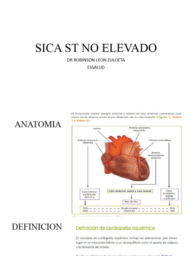 SICA ST NO ELEVADO | PDF | Infarto de miocardio | Electrocardiografia