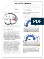 Prótese Parcial Removível: Apoios