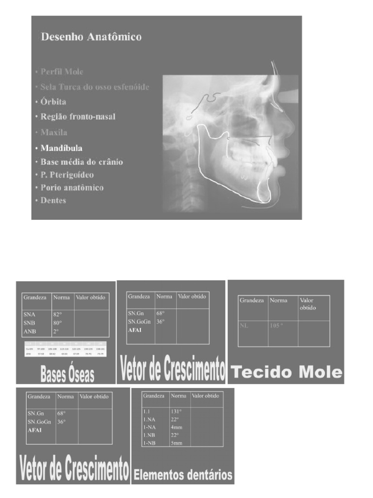 CEFALOGRAMA | PDF