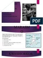 Clasificacion de La Desnutricion