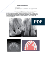 Anomalias Dentárias de Número