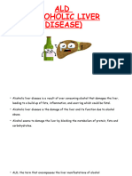 ALD (Alcoholic Liver Disease)