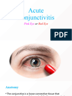 Acute Conjunctivitis