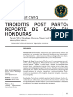 Tiroidis Posparto