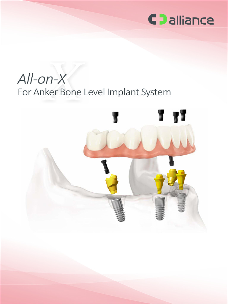 All-on-X EN 2019 | PDF
