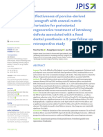 2021 - Effectiveness of Porcine-Derived Xenograft With Enamel Matrix Derivative for Periodontal Regenerative Treatment of Intrabony Defects Associated With a Fixed Dental Prosthesis: A 2-Year Follow-up Retrospective Study