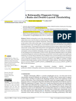 Proliferative Diabetic Retinopathy Diagnosis Using Varying Scales Filter Banks and Double Layered Thresholding