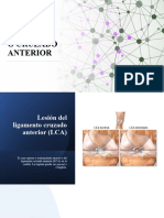 Rotura Ligamento Cruzado Anterior