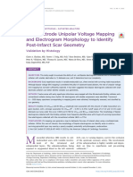 Tofig Et Al 2022 Multielectrode Unipolar Voltage Mapping and Electrogram Morphology To Identify Post Infarct Scar