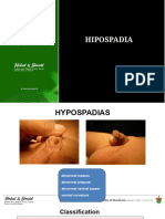 Hipospadia Compressed