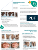 Prosthetic Finger Hand Guide 2021 Medical Art Resources