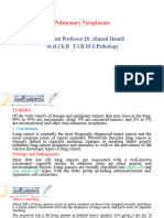 lec. 4 Pulmonary Neoplasms.. saif 