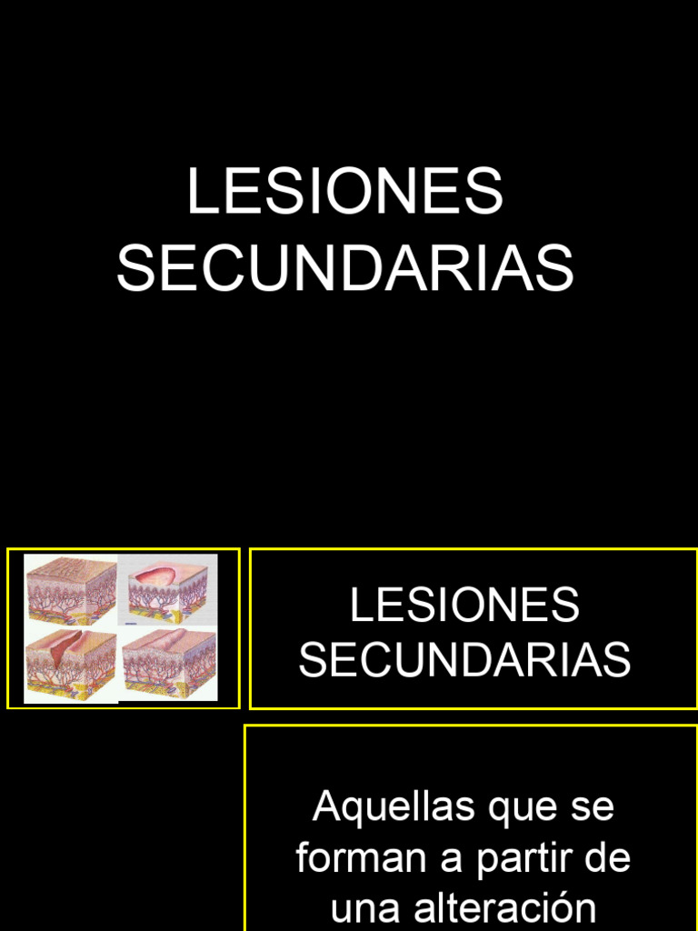 Lesiones Secundarias de La Piel PDF Piel Especialidades Medicas