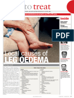 Leg Oedema