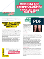 Legs Matter Patients Swollen Legs Feet A4