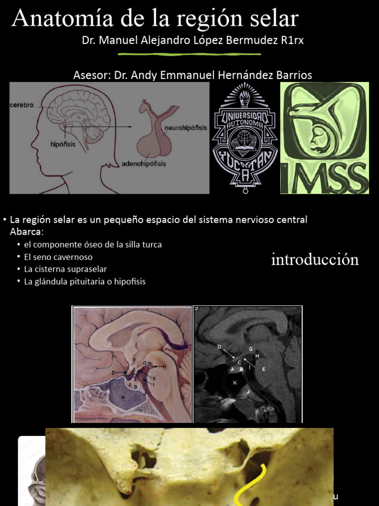 Anatomía de la Región Selar y Supraselar | PDF | Glándula pituitaria ...