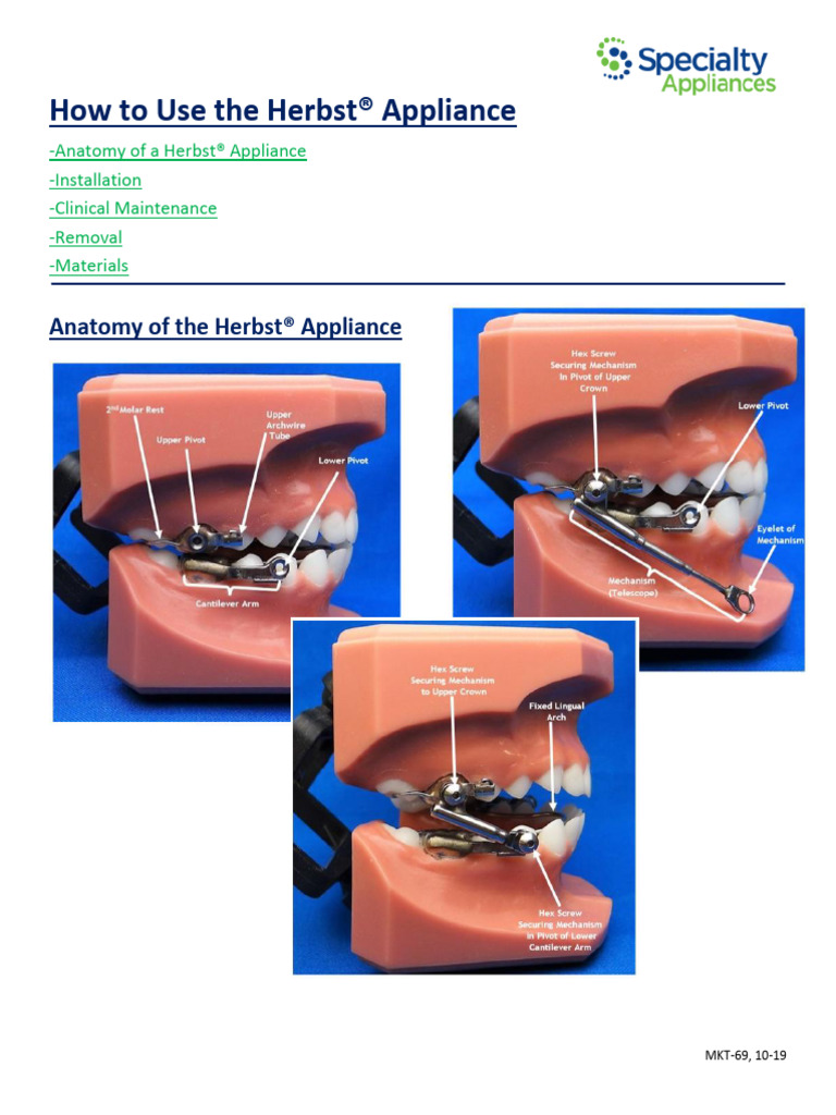 Herbst Appliance PDF Mouth Tooth