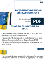 EPOC II