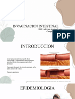 Invaginacion Intestinal