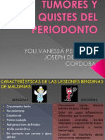 Tumores y Quistes Del Period On To