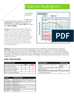 2. How to Read Audiogram