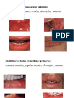 Semiologia Da Cavidade Oral2