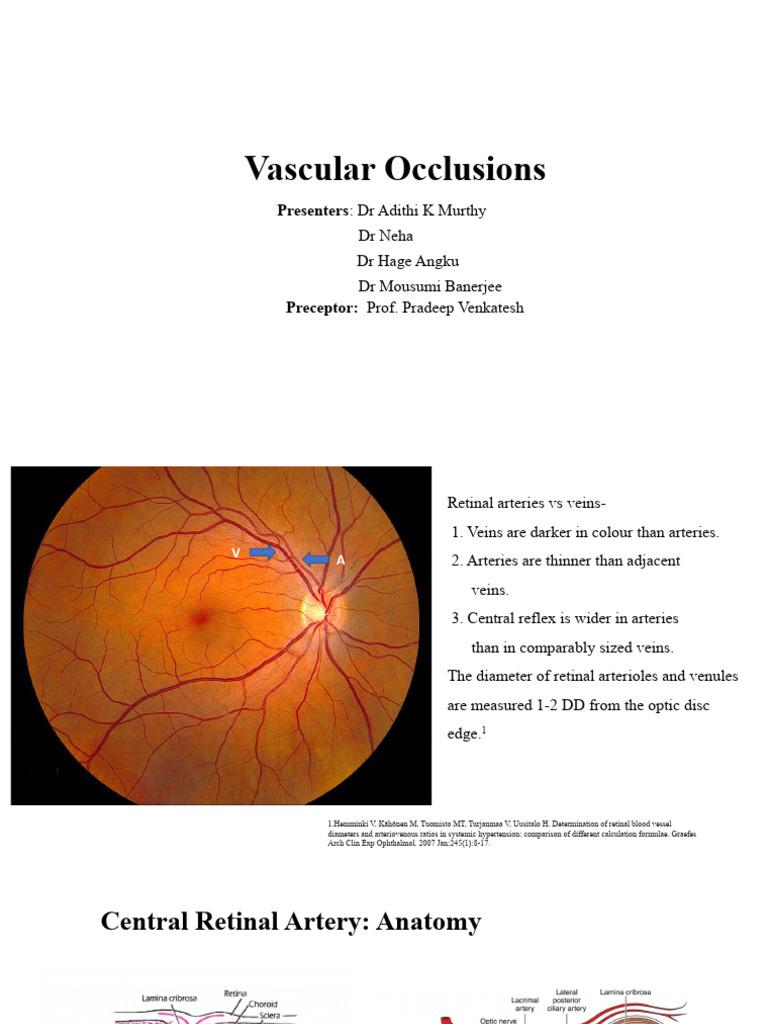 Vascular Occlusions: Presenters: DR Adithi K Murthy | PDF | Vein | Artery
