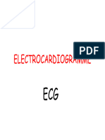 ECG (explications tres claires)