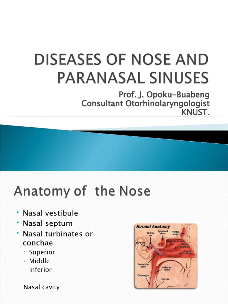 Understanding Nasal Anatomy and Disorders | PDF | Human Nose | Clinical ...