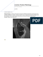 Radsource - Us-Proximal Gastrocnemius Tendon Pathology