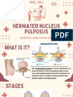 Herniated Nucleus Pulposus