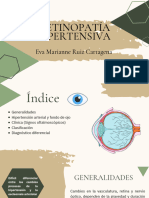 Retinopatía Hipertensiva 