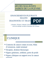 Tumeurs Malignes Secondaires de La Plevre: Epanchements Pleuraux Malins Diagnostic Et Traitements