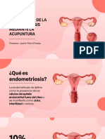 Endometriosis