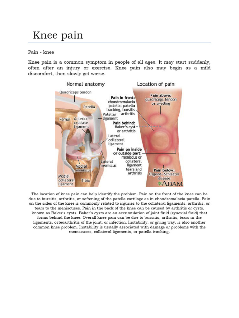 Homeopathic Remedies for Knee Pain | PDF | Knee | Arthritis
