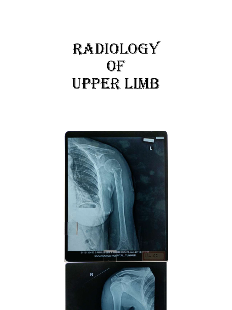 X Ray | PDF