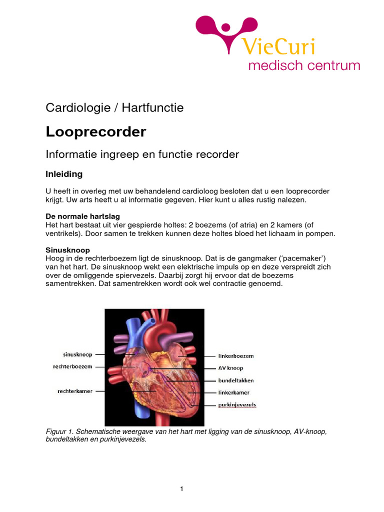 Looprecorder | PDF