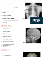 x rays head, neck, chest