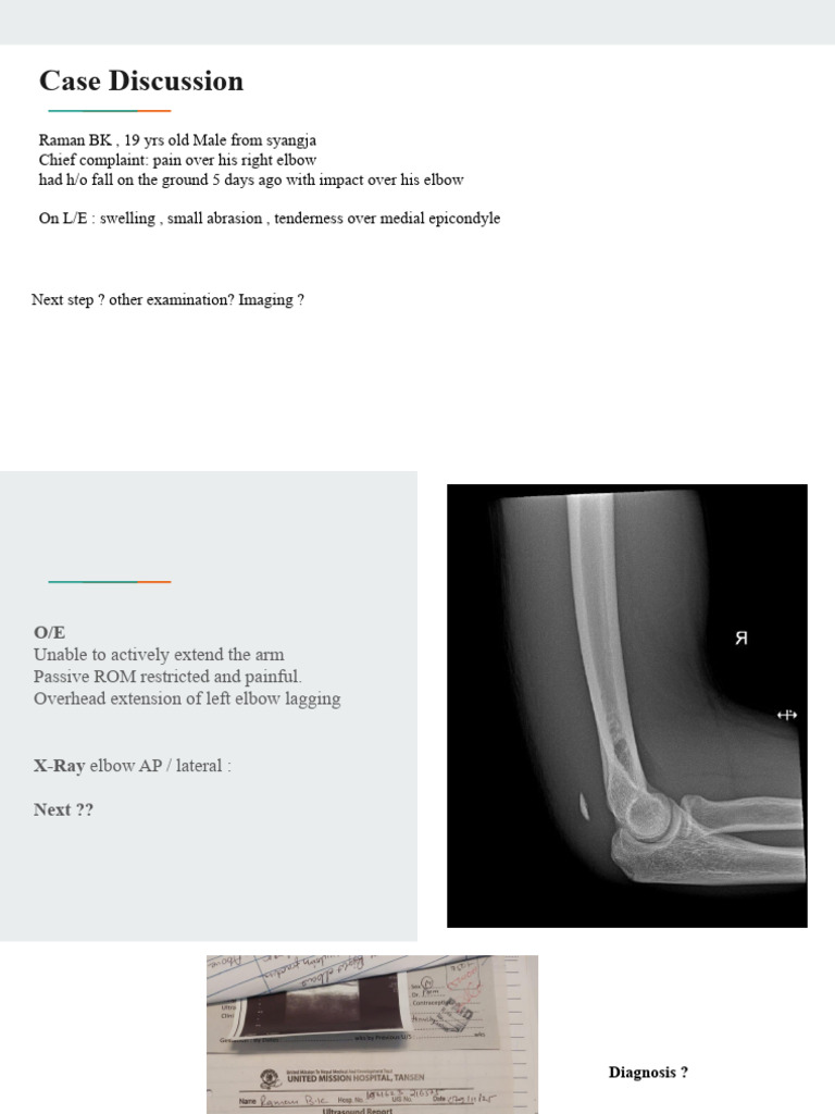 Triceps Tendon Rupture PPT - DR Krishpeena | PDF | Elbow ...