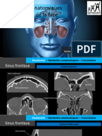 Variantes Anatomiques Des Sinus de La Face RD 2019